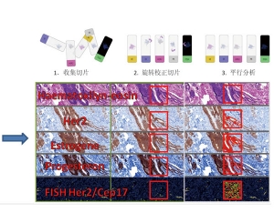 肿瘤筛查分析软件