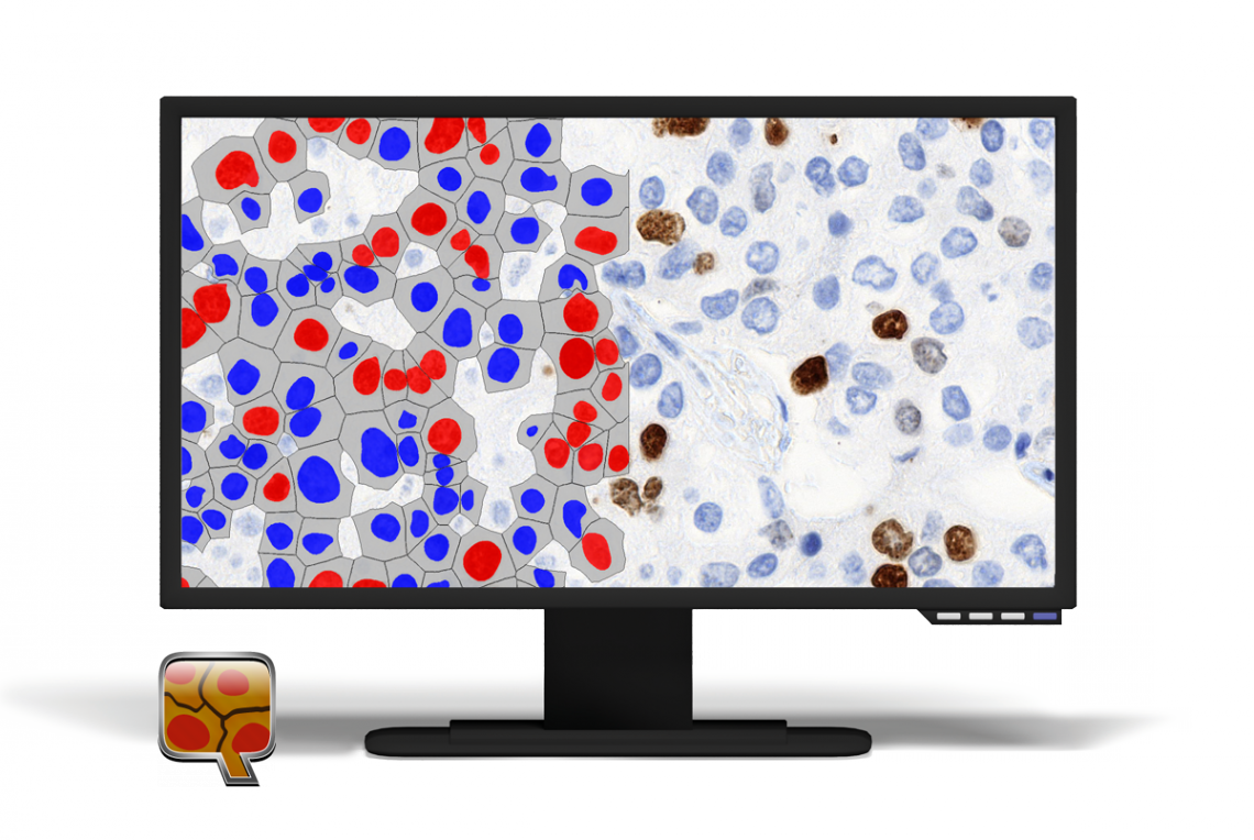 1506067282721428.png 1506067282721428.png